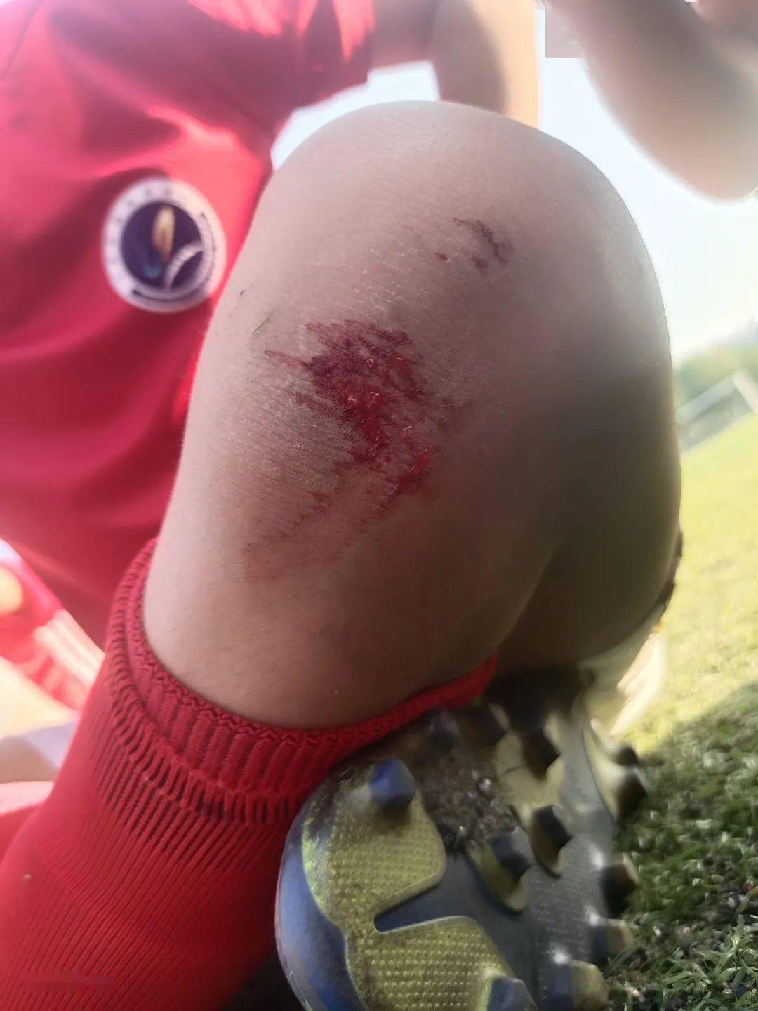 阿尔勒斯堡球员努力拼搏，不畏强敌